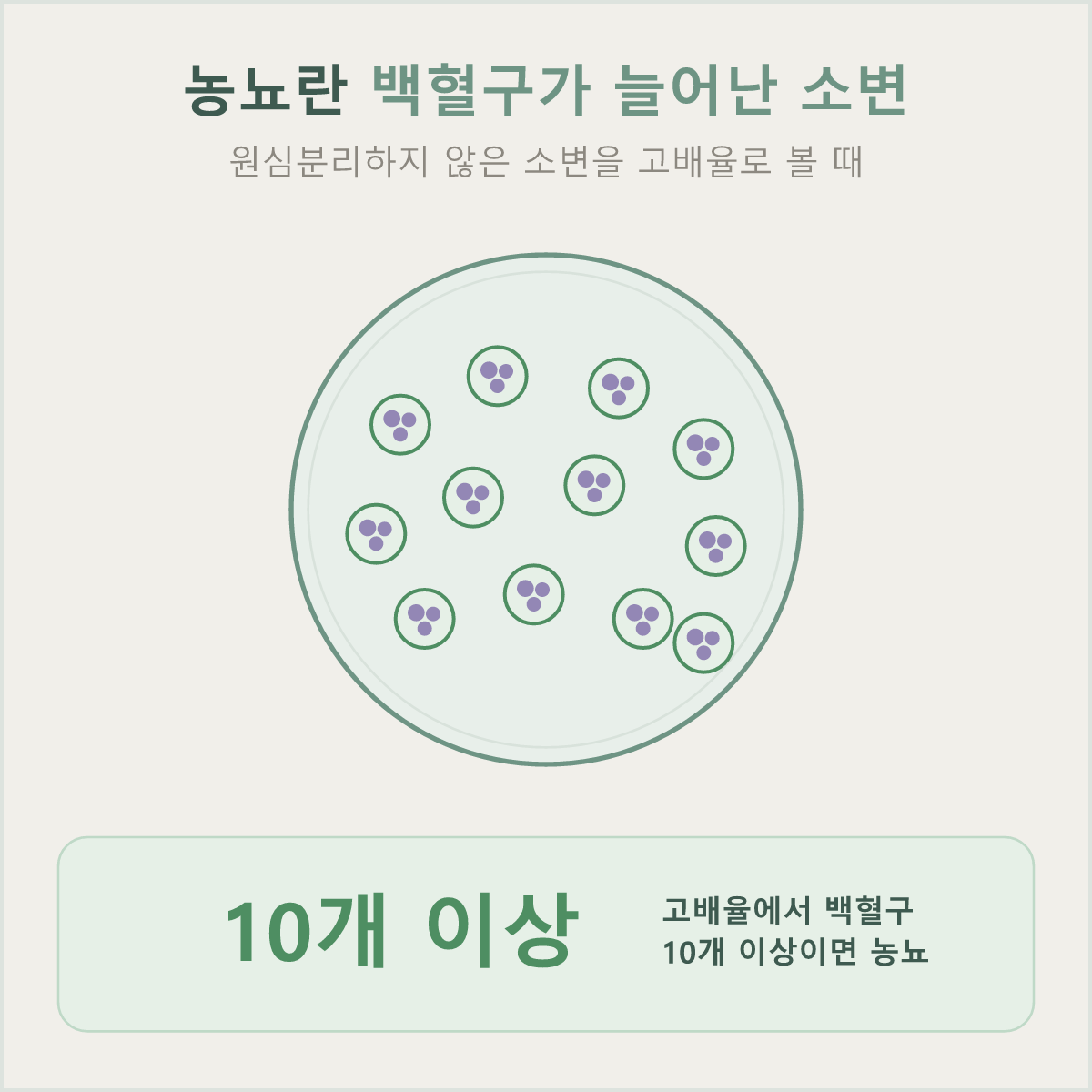 원심분리하지 않은 소변을 고배율로 볼 때 백혈구가 10개 이상이면 농뇨